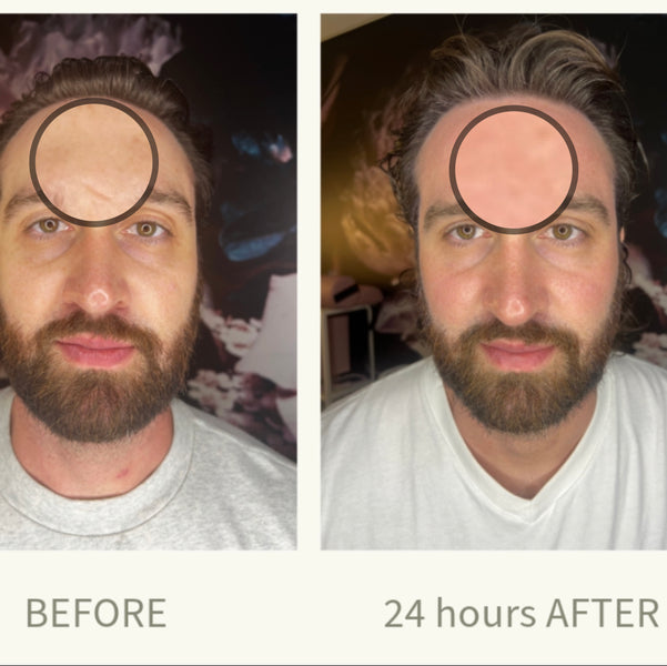 Discover the Magic of Procell MD: A Game-Changer for Skin Rejuvenation!